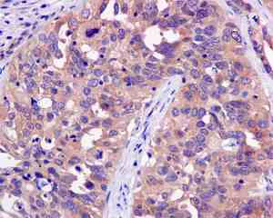 Immunohistochemistry (Formalin/PFA-fixed paraffin-embedded sections) - Anti-TCP1 eta antibody [EPR10944(B)] - BSA and Azide free (AB249375)