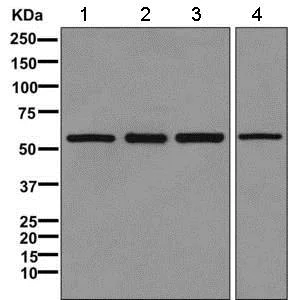 Western blot - Anti-TCP1 eta antibody [EPR10944(B)] - BSA and Azide free (AB249375)