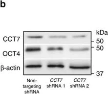 Western blot - Anti-TCP1 eta antibody [EPR10945(B)] (AB170861)