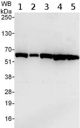 Western blot - Anti-TCP1 theta antibody (AB176691), expandable thumbnail