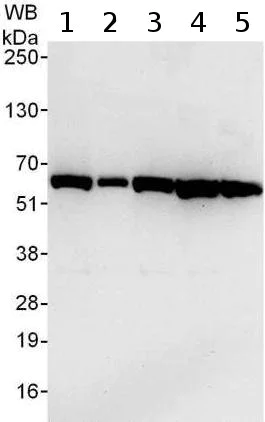 Western blot - Anti-TCP1 theta antibody (AB176691)