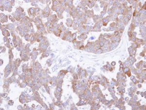 Immunohistochemistry (Formalin/PFA-fixed paraffin-embedded sections) - Anti-TCP1 theta antibody (AB96321)
