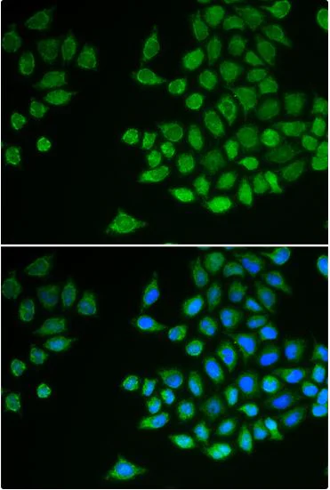 Immunocytochemistry/ Immunofluorescence - Anti-TCPTP antibody (AB180764)