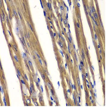 Immunohistochemistry (Formalin/PFA-fixed paraffin-embedded sections) - Anti-TCPTP antibody (AB180764)