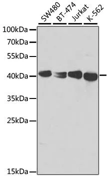Western blot - Anti-TCPTP antibody (AB180764)