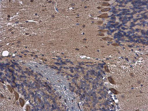 Immunohistochemistry (Formalin/PFA-fixed paraffin-embedded sections) - Anti-TCPTP antibody (AB227916)