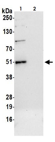 Immunoprecipitation - Anti-TCPTP antibody (AB264379), expandable thumbnail