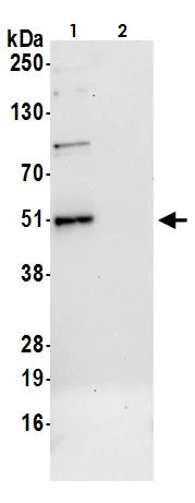 Immunoprecipitation - Anti-TCPTP antibody (AB264379)