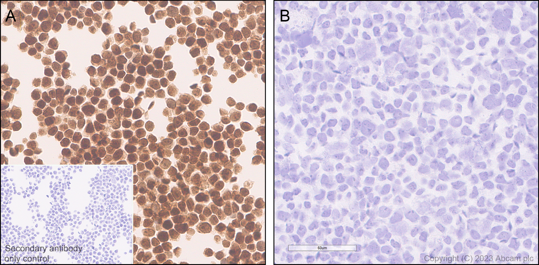 Immunohistochemistry (Formalin/PFA-fixed paraffin-embedded sections) - Anti-TCPTP antibody [EPR28199-34] - BSA and Azide free (ab314497), expandable thumbnail