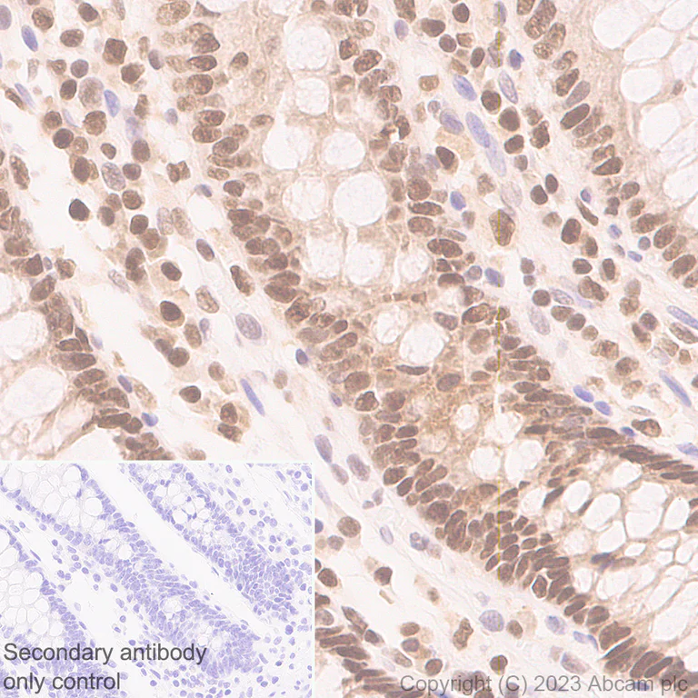 Immunohistochemistry (Formalin/PFA-fixed paraffin-embedded sections) - Anti-TCPTP antibody [EPR28199-34] - BSA and Azide free (AB314497)
