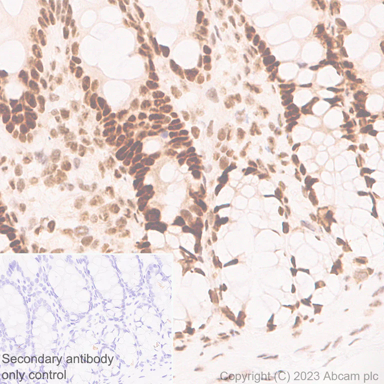 Immunohistochemistry (Formalin/PFA-fixed paraffin-embedded sections) - Anti-TCPTP antibody [EPR28199-34] - BSA and Azide free (AB314497)