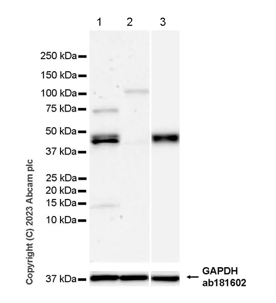 Western blot - Anti-TCPTP antibody [EPR28199-34] - BSA and Azide free (AB314497)
