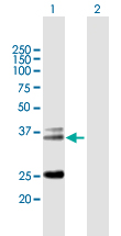 Western blot - Anti-TCR alpha antibody (AB167645)