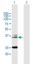 Western blot - Anti-TCR alpha antibody (AB167645)