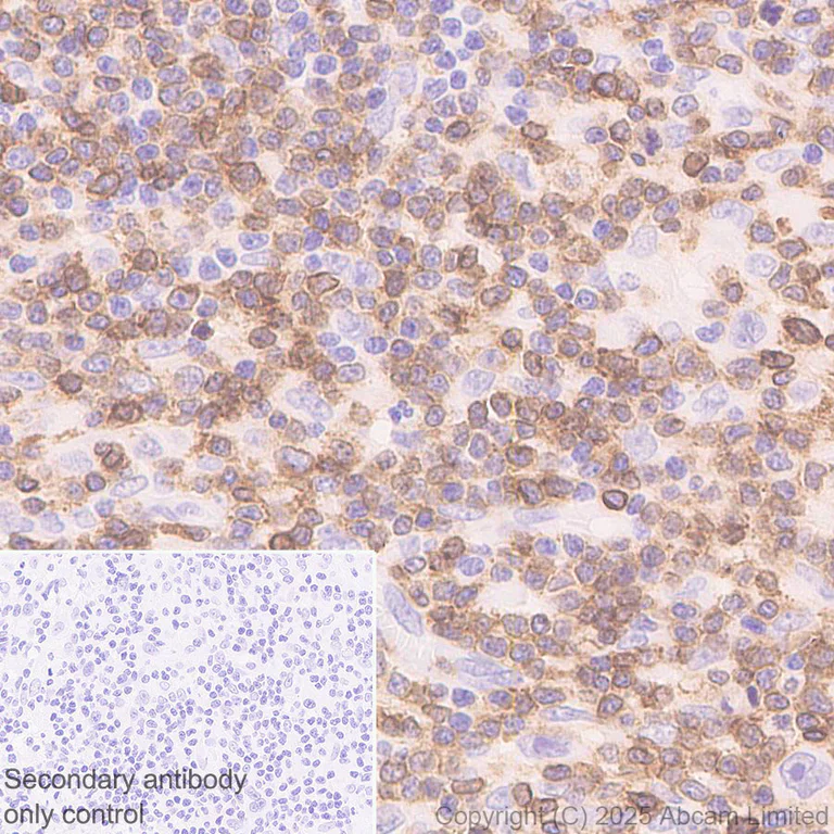Immunohistochemistry (Formalin/PFA-fixed paraffin-embedded sections) - Anti-TCR alpha antibody [EPR29621-40] (AB324527)