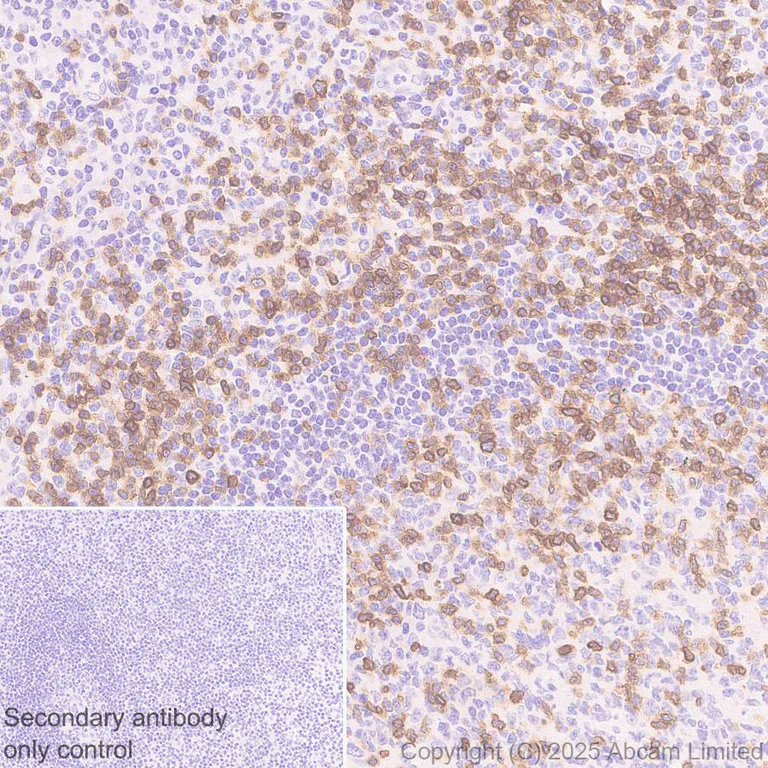 Immunohistochemistry (Formalin/PFA-fixed paraffin-embedded sections) - Anti-TCR alpha antibody [EPR29621-40] - BSA and Azide free (AB324535)