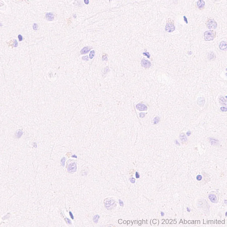 Immunohistochemistry (Formalin/PFA-fixed paraffin-embedded sections) - Anti-TCR alpha antibody [EPR29621-40] - BSA and Azide free (AB324535)