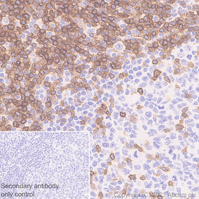 Immunohistochemistry (Formalin/PFA-fixed paraffin-embedded sections) - Anti-TCR beta antibody [EPR24928-66] (AB315324)