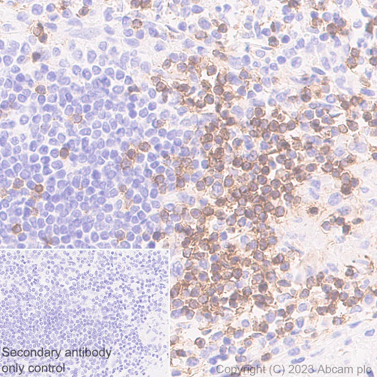 Immunohistochemistry (Formalin/PFA-fixed paraffin-embedded sections) - Anti-TCR beta antibody [EPR24928-66] (AB315324)