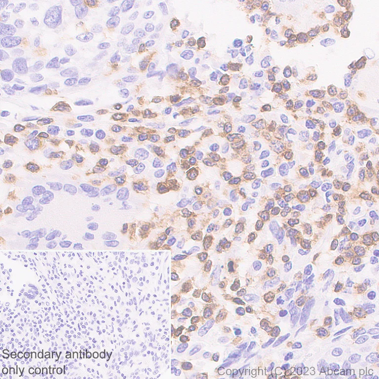 Immunohistochemistry (Formalin/PFA-fixed paraffin-embedded sections) - Anti-TCR beta antibody [EPR24928-66] (AB315324)