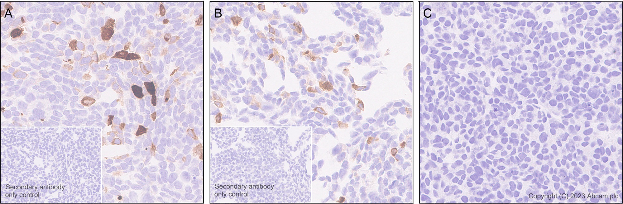 Immunohistochemistry (Formalin/PFA-fixed paraffin-embedded sections) - Anti-TCR beta antibody [EPR24928-66] (AB315324)