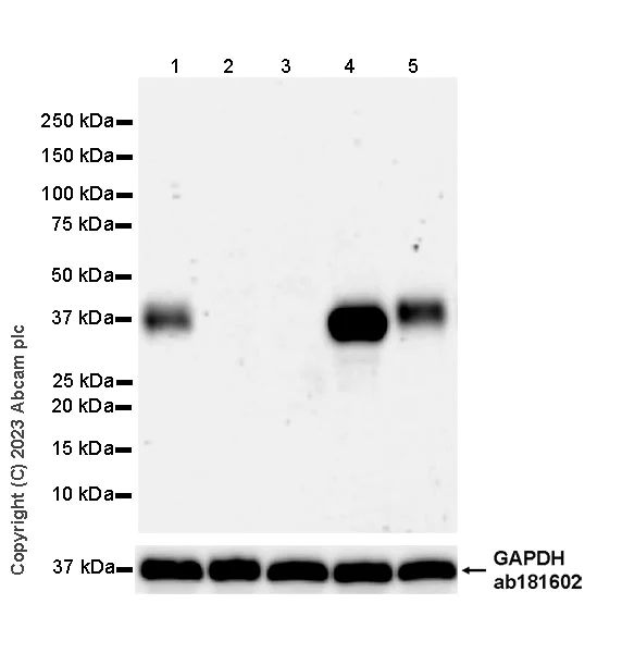 Western blot - Anti-TCR beta antibody [EPR24928-66] (AB315324)