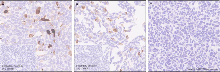 Immunohistochemistry (Formalin/PFA-fixed paraffin-embedded sections) - Anti-TCR beta antibody [EPR24928-66] - BSA and Azide free (AB315325)