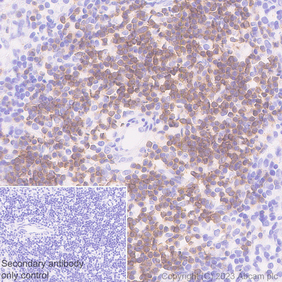 Immunohistochemistry (Formalin/PFA-fixed paraffin-embedded sections) - Anti-TCR beta antibody [EPR27870-34] (ab313579), expandable thumbnail