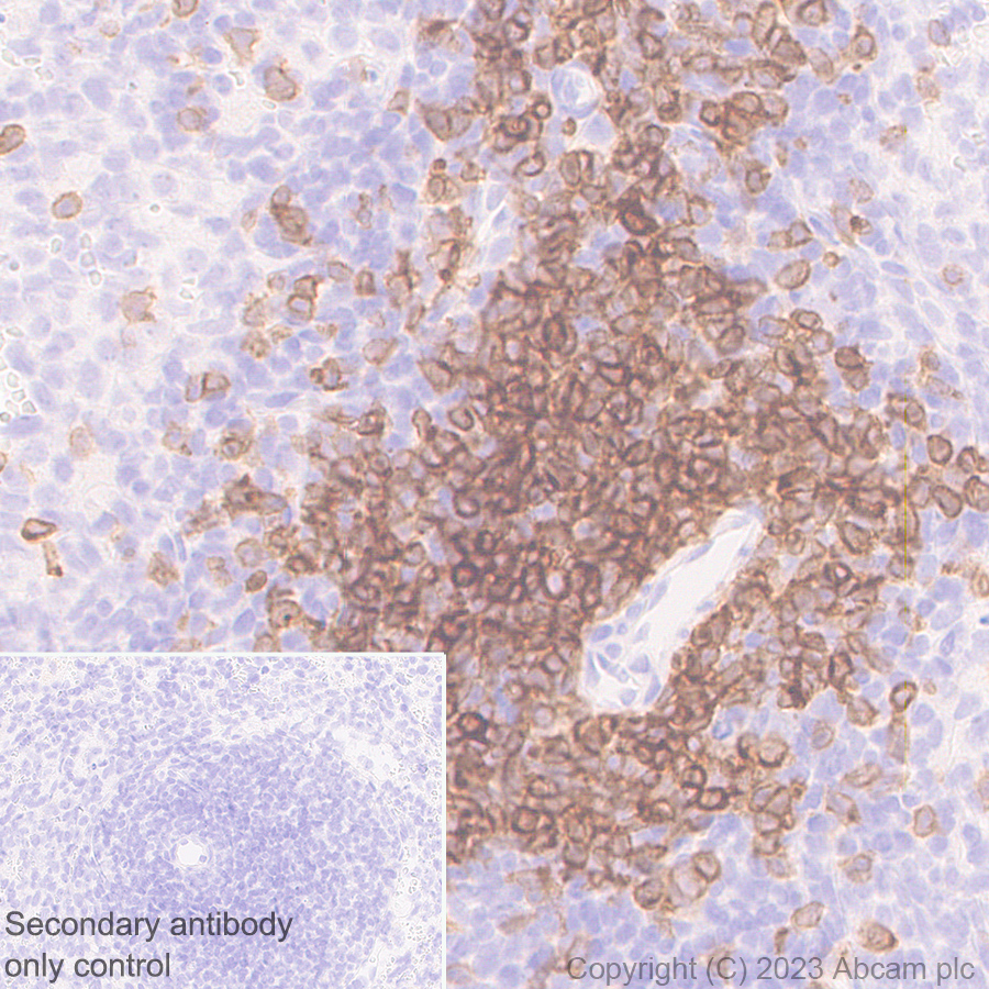 Immunohistochemistry (Formalin/PFA-fixed paraffin-embedded sections) - Anti-TCR beta antibody [EPR27870-34] (ab313579), expandable thumbnail