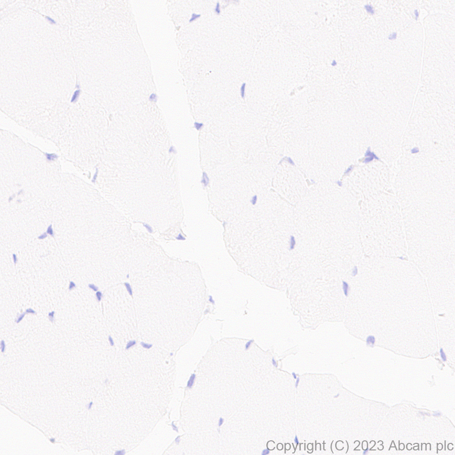 Immunohistochemistry (Formalin/PFA-fixed paraffin-embedded sections) - Anti-TCR beta antibody [EPR27870-34] (ab313579), expandable thumbnail