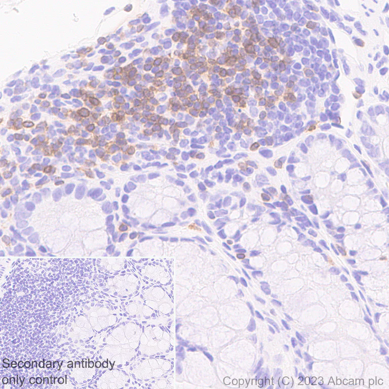 Immunohistochemistry (Formalin/PFA-fixed paraffin-embedded sections) - Anti-TCR beta antibody [EPR27870-34] - BSA and Azide free (AB313580)