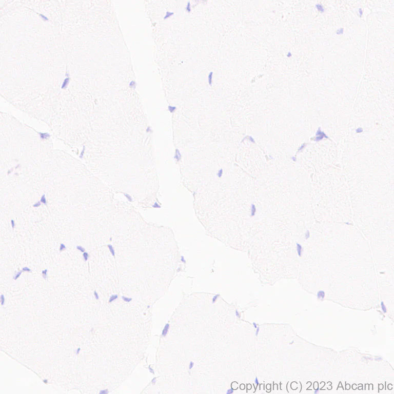 Immunohistochemistry (Formalin/PFA-fixed paraffin-embedded sections) - Anti-TCR beta antibody [EPR27870-34] - BSA and Azide free (AB313580)