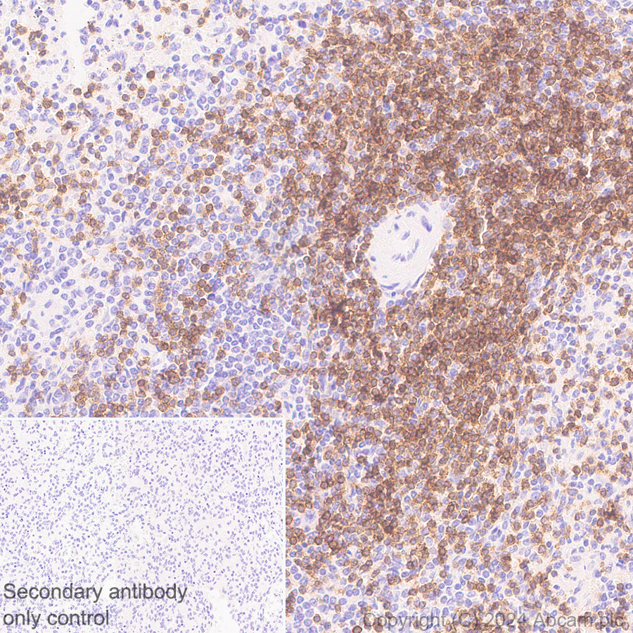 Immunohistochemistry (Formalin/PFA-fixed paraffin-embedded sections) - Anti-TCR beta antibody [RM2056] (AB318205), expandable thumbnail