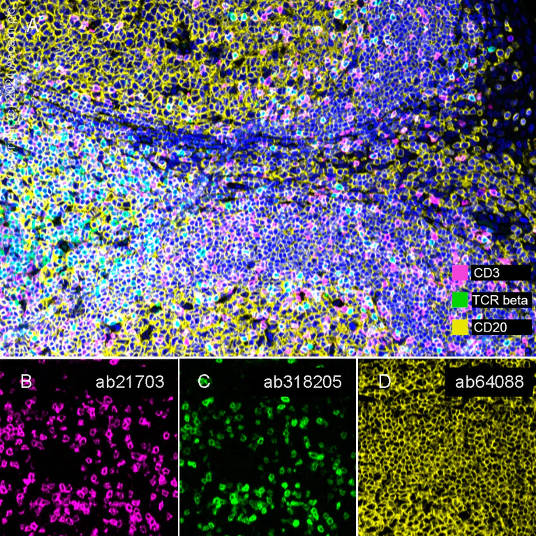 Multiplex immunohistochemistry - Anti-TCR beta antibody [RM2056] (AB318205)