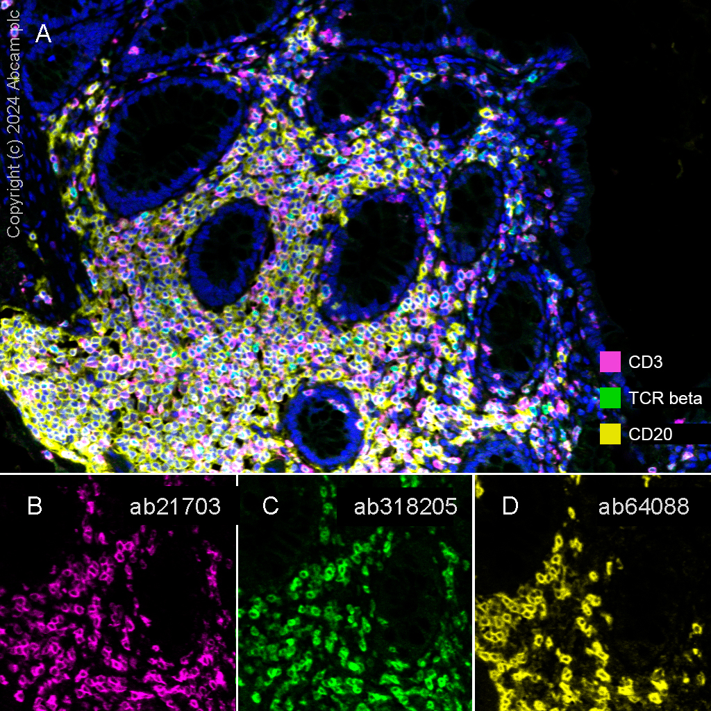 Multiplex immunohistochemistry - Anti-TCR beta antibody [RM2056] (AB318205), expandable thumbnail