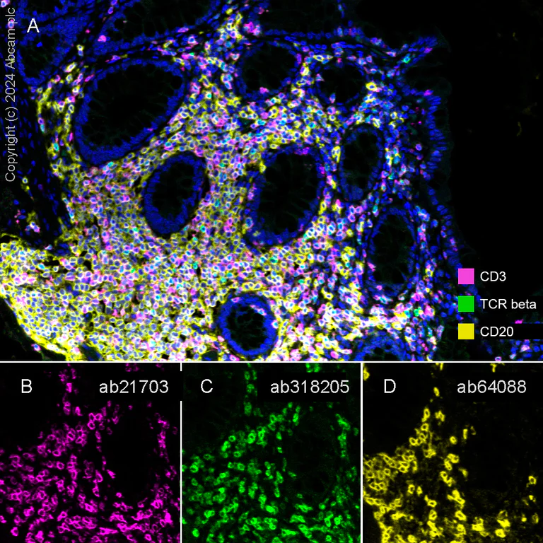 Multiplex immunohistochemistry - Anti-TCR beta antibody [RM2056] (AB318205)