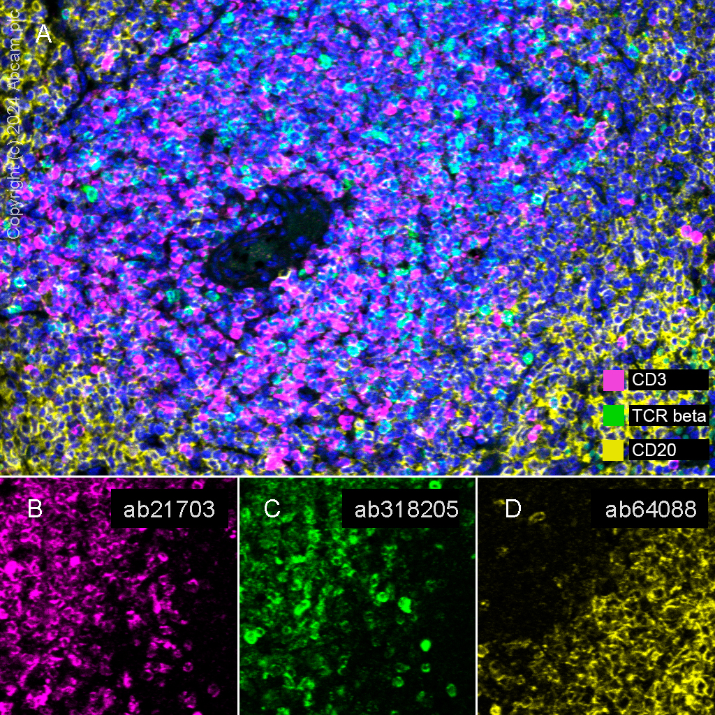 Multiplex immunohistochemistry - Anti-TCR beta antibody [RM2056] (ab318205), expandable thumbnail