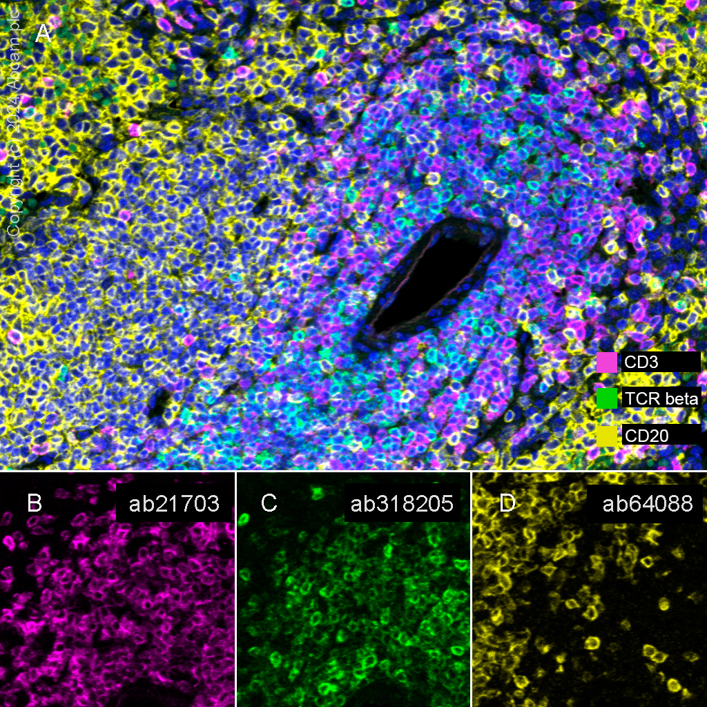 Multiplex immunohistochemistry - Anti-TCR beta antibody [RM2056] (ab318205), expandable thumbnail