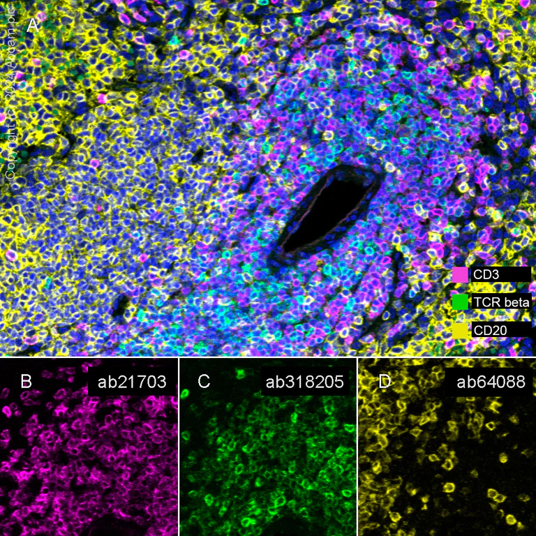Multiplex immunohistochemistry - Anti-TCR beta antibody [RM2056] (AB318205)