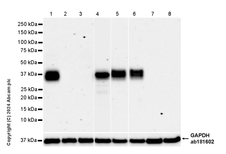 Western blot - Anti-TCR beta antibody [RM2056] (ab318205), expandable thumbnail
