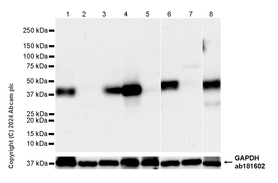 Western blot - Anti-TCR beta antibody [RM2056] (AB318205), expandable thumbnail