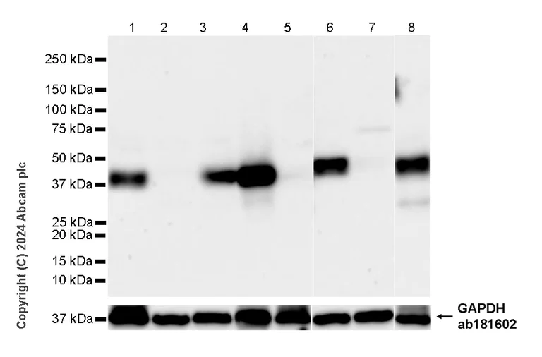 Western blot - Anti-TCR beta antibody [RM2056] (AB318205)