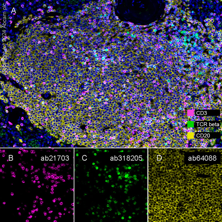 Multiplex immunohistochemistry - Anti-TCR beta antibody [RM2056] - BSA and Azide free (AB318206)