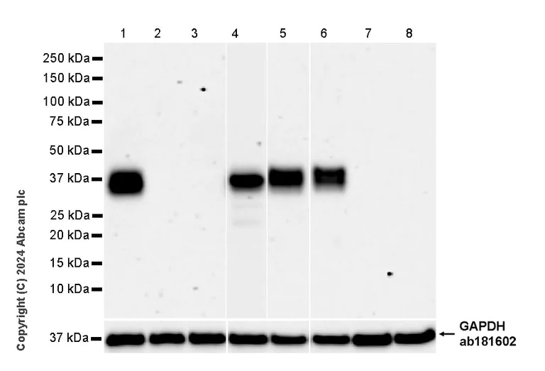 Western blot - Anti-TCR beta antibody [RM2056] - BSA and Azide free (AB318206)