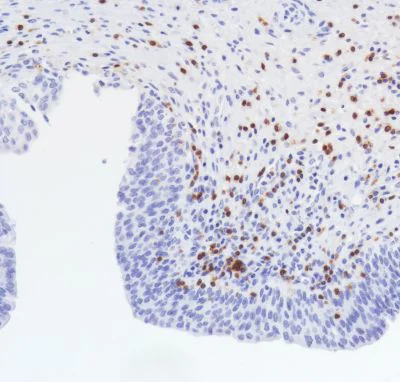 Immunohistochemistry (Formalin/PFA-fixed paraffin-embedded sections) - Anti-TCR beta antibody [SP305] - BSA and Azide free (AB325979)