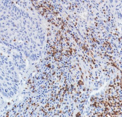 Immunohistochemistry (Formalin/PFA-fixed paraffin-embedded sections) - Anti-TCR beta antibody [SP305] - BSA and Azide free (AB325979)
