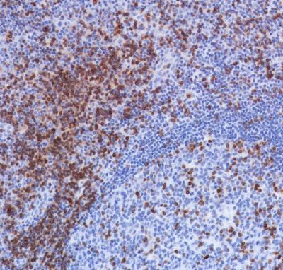 Immunohistochemistry (Formalin/PFA-fixed paraffin-embedded sections) - Anti-TCR beta antibody [SP305] - BSA and Azide free (AB325979)