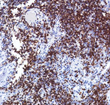 Immunohistochemistry (Formalin/PFA-fixed paraffin-embedded sections) - Anti-TCR beta antibody [SP305] - BSA and Azide free (AB325979)