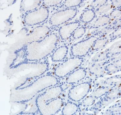 Immunohistochemistry (Formalin/PFA-fixed paraffin-embedded sections) - Anti-TCR beta antibody [SP305] - BSA and Azide free (AB325979)