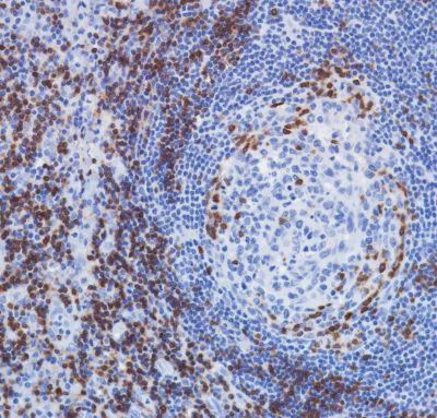 Immunohistochemistry (Formalin/PFA-fixed paraffin-embedded sections) - Anti-TCR beta antibody [SP305] - BSA and Azide free (AB325979)
